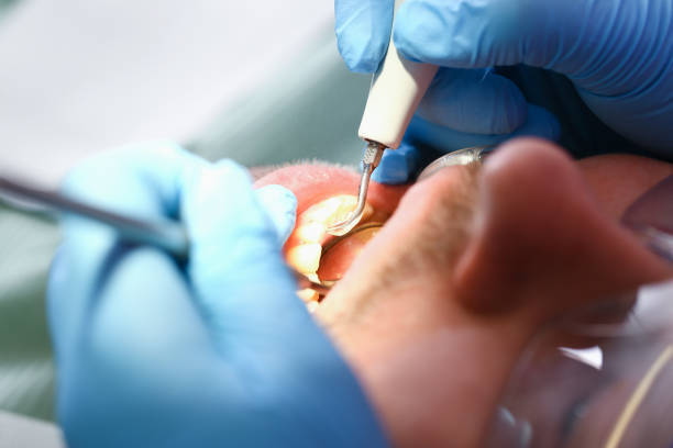 Best Weekend Emergency Dentist in Cramerton, NC